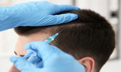 Ankara Saç Kök Hücre Tedavisi ile Sağlıklı Saçlara Sahip Olun