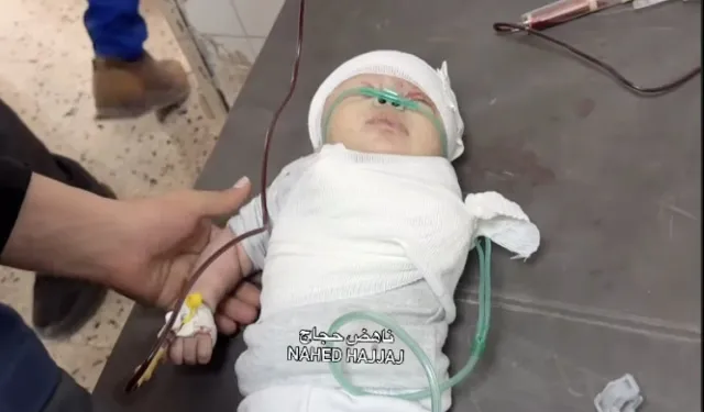 Gazze’de Minik Bir Bebeğin Dramı: İsrail Saldırısında Kolu Koptu