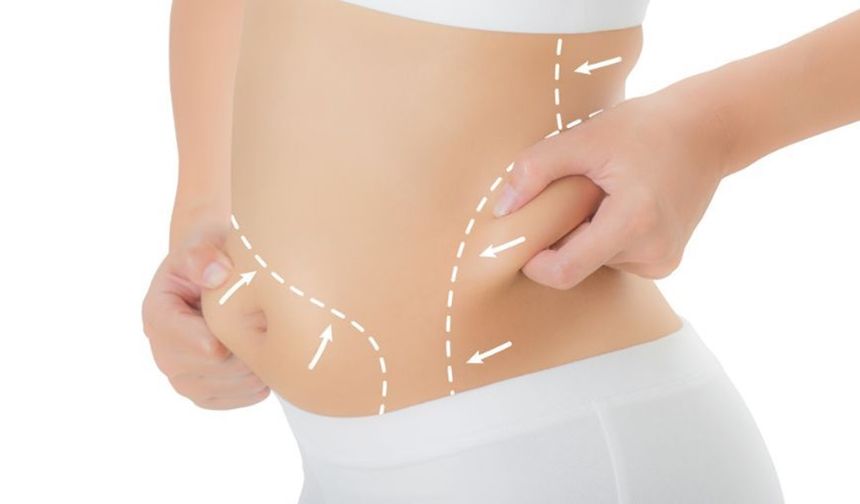 Liposuction ile Yağlarınızdan Kurtulun